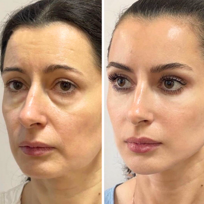 Biancat® LiftRenew All-in-One Augenpflege-Stift