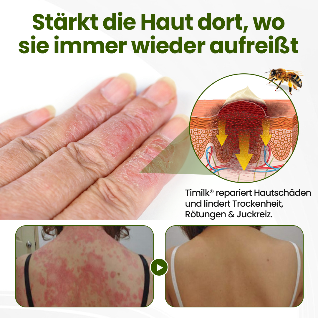 Timilk® BeePeptide RootSoft DualRelief-Creme