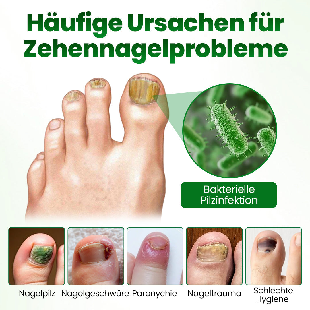 Timilk® HerbaNail 7-Tage Repair-Serum 🔥 FDA-zertifiziert (Klinisch bewährte Kräuterformel für 7-Tage-Nagelpilz-Reparatur & Stärkungsaufbau 🌿)