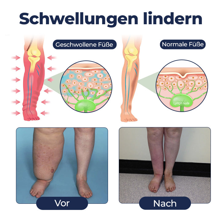 Timilk® SwellRelief Durchblutungsunterstützende Creme 🔥