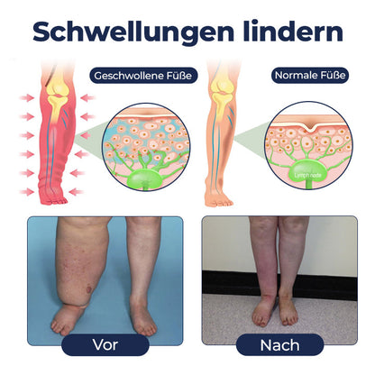 Timilk® SwellRelief Durchblutungsunterstützende Creme 🔥