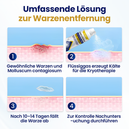 Timilk® ChillErase Erneuerungs-Spray gegen Hautunreinheiten🔥