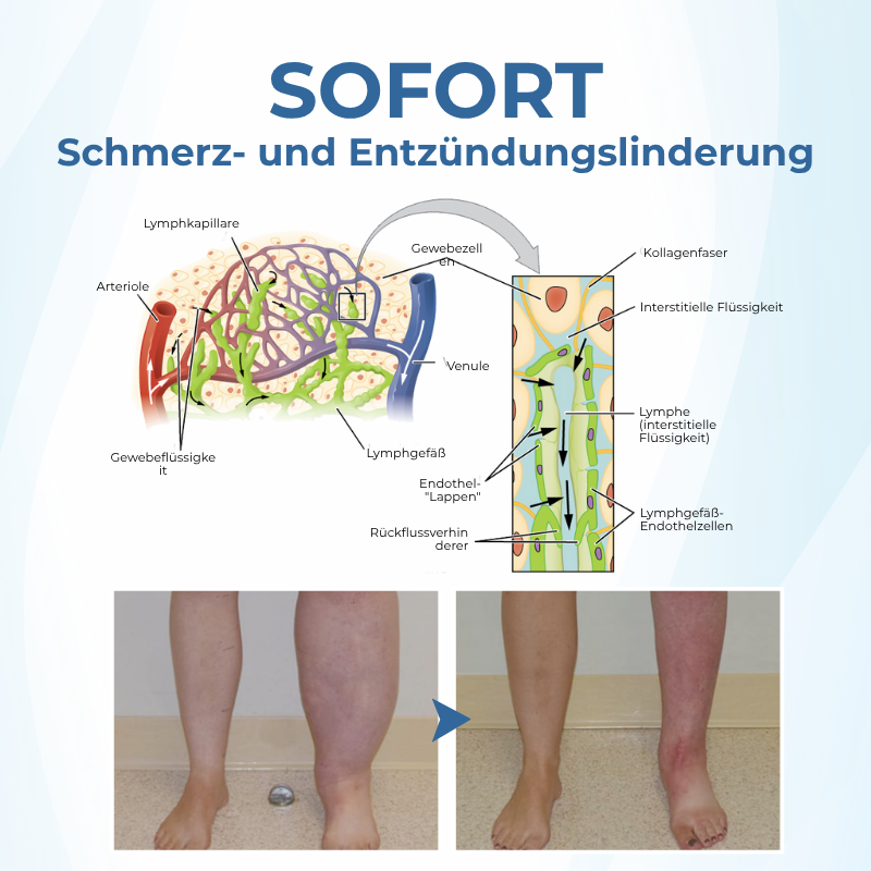 Timilk® TheraVein Kräuter-Spray gegen Krampfadern 🔥