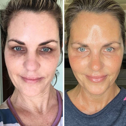 Biancat® LiftRenew All-in-One Augenpflege-Stift