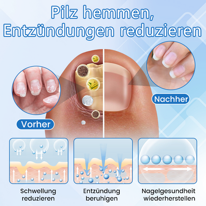 ✅ Offizieller Shop: Timilk® DermaMag Magnesium-Reparaturspray 🔥