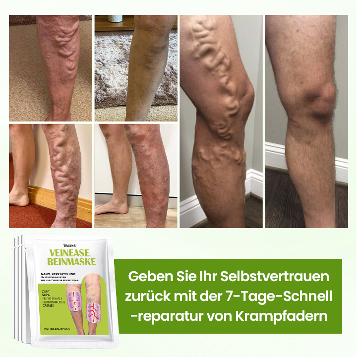Timilk® VeinEase Beinmaske