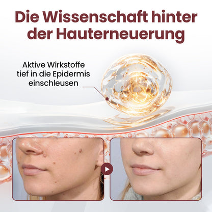 Biancat® KeraErase Dual-Action Erneuerungscreme