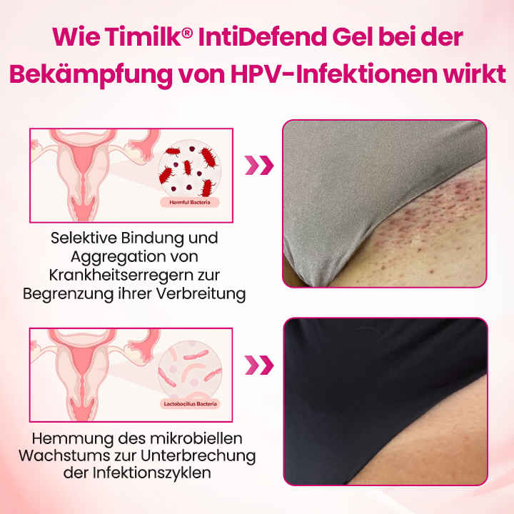 Timilk® IntiDefend Anti-HPV Interferon-Gel🔥