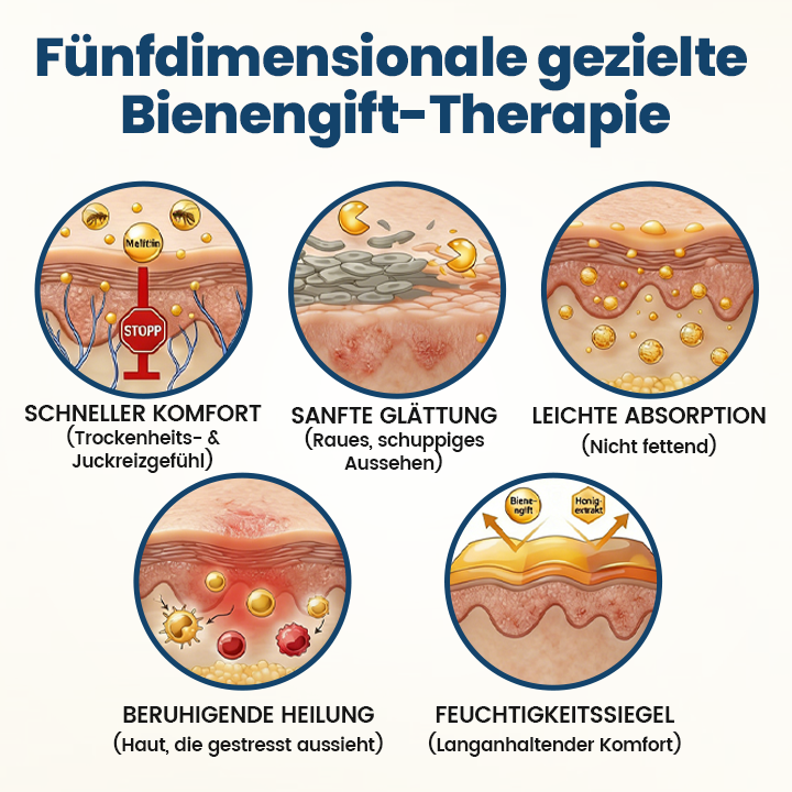 Timilk® BeeVenom Psoriasis-Behandlungscreme ❤️