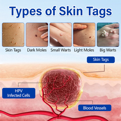 Timilk® WartClear Kräuter-Salbe