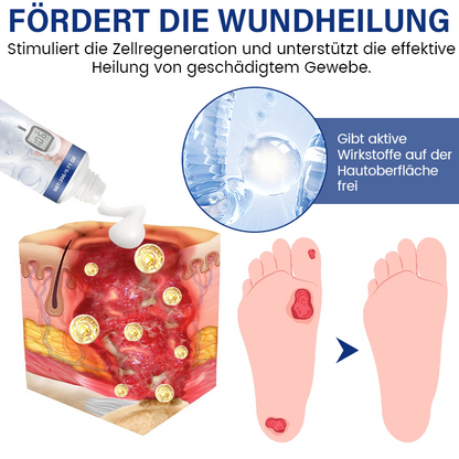 Timilk® SugarRelief Creme zur Behandlung von Diabetes 🔥