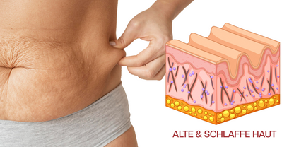 Timilk® AuréLuxe Körperstraffendes Öl 🇩🇪