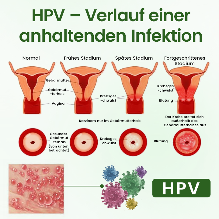 Timilk® FeminaDefend All-In-One Intimpflege-Pads🔥