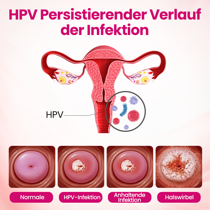 Timilk® IntiDefend Anti-HPV Interferon-Gel🔥