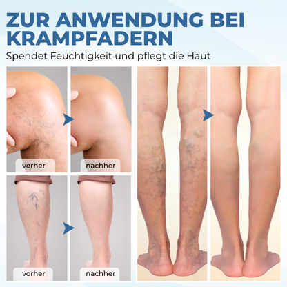 Timilk® TheraVein Kräuter-Spray gegen Krampfadern 🔥