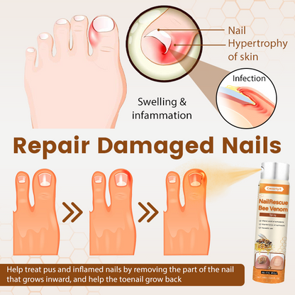 Ceoerty® NailRescue Bienengift-Spray🔥