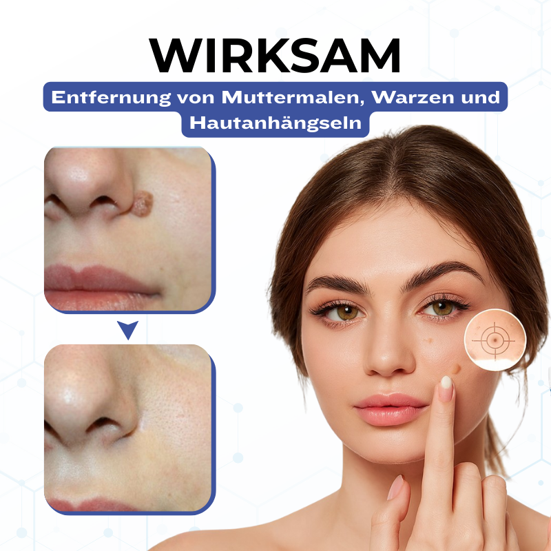 Timilk® VanishPro Hautflecken-Entfernungscreme 🇩🇪