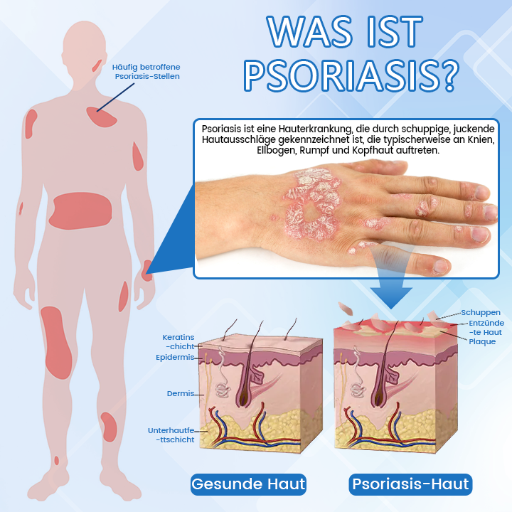 ✅ Offizieller Shop: Timilk® DermaMag Magnesium-Reparaturspray 🔥