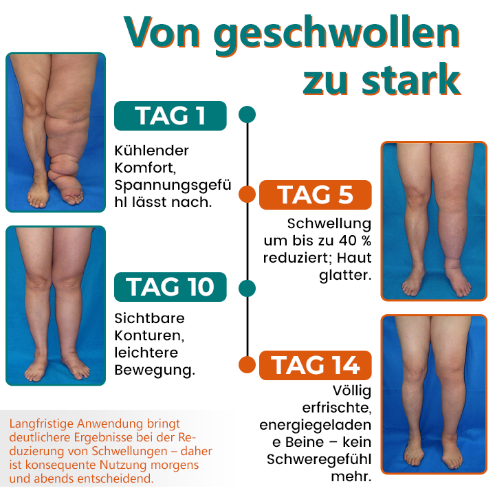 Timilk® LymphoEase Magnesium Roll-On Schmerzlinderungscreme