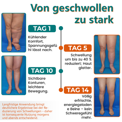 Timilk® LymphoEase Magnesium Roll-On Schmerzlinderungscreme