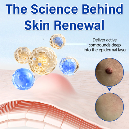 Timilk® WartClear Kräuter-Salbe