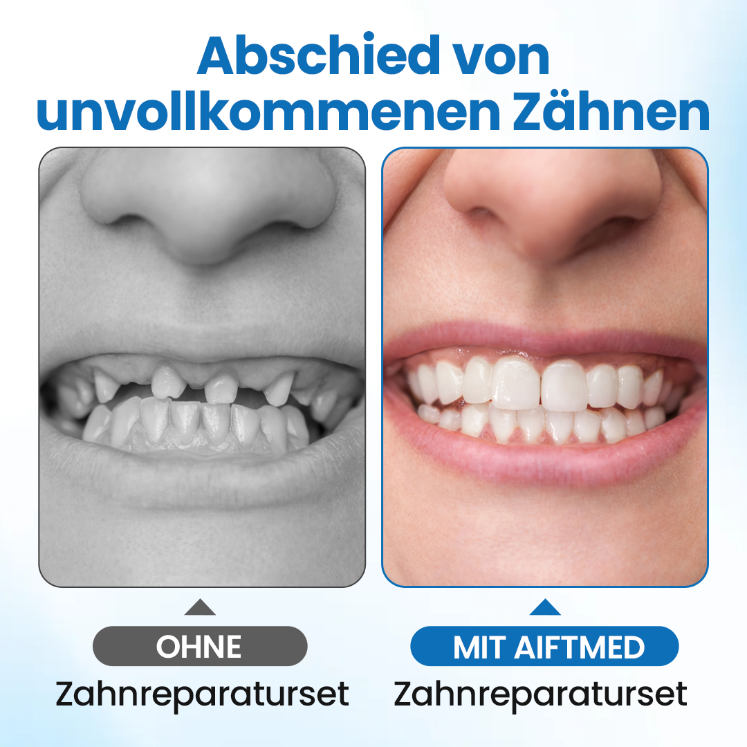 Timilk® SmileMend Zahnreparatur-Füllungsset