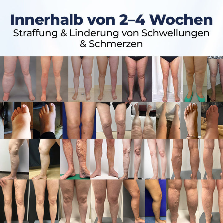 Timilk® SwellRelief Durchblutungsunterstützende Creme 🔥