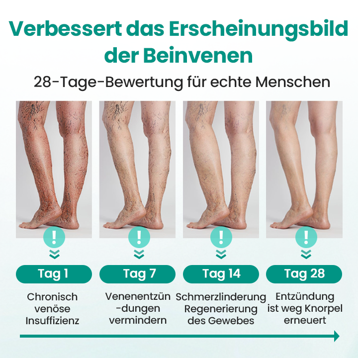 Timilk® LegRenew Krampfaderpflaster