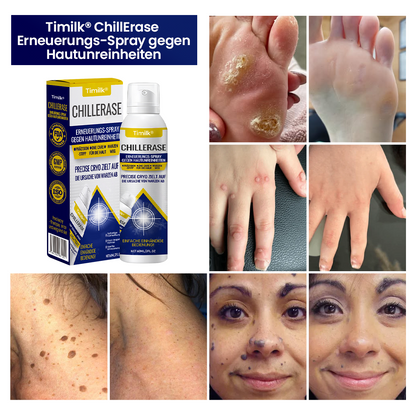 Timilk® ChillErase Erneuerungs-Spray gegen Hautunreinheiten🔥