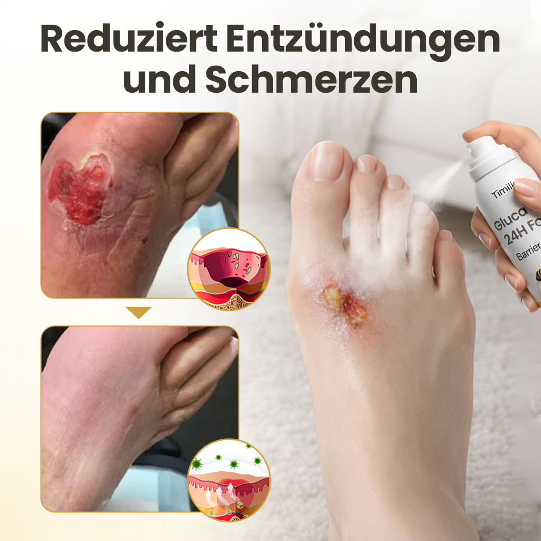 Timilk® GlucaVeil 24H Fuß-Barriere-Spray 🔥