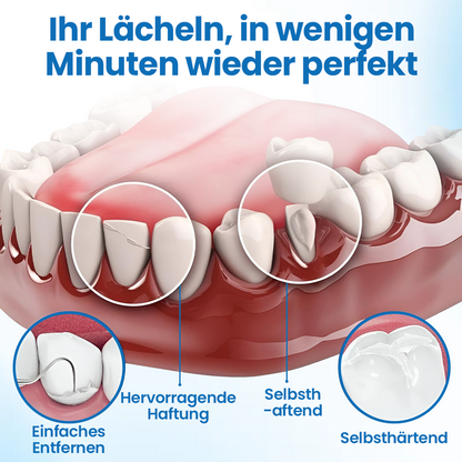 Timilk® SmileMend Zahnreparatur-Füllungsset