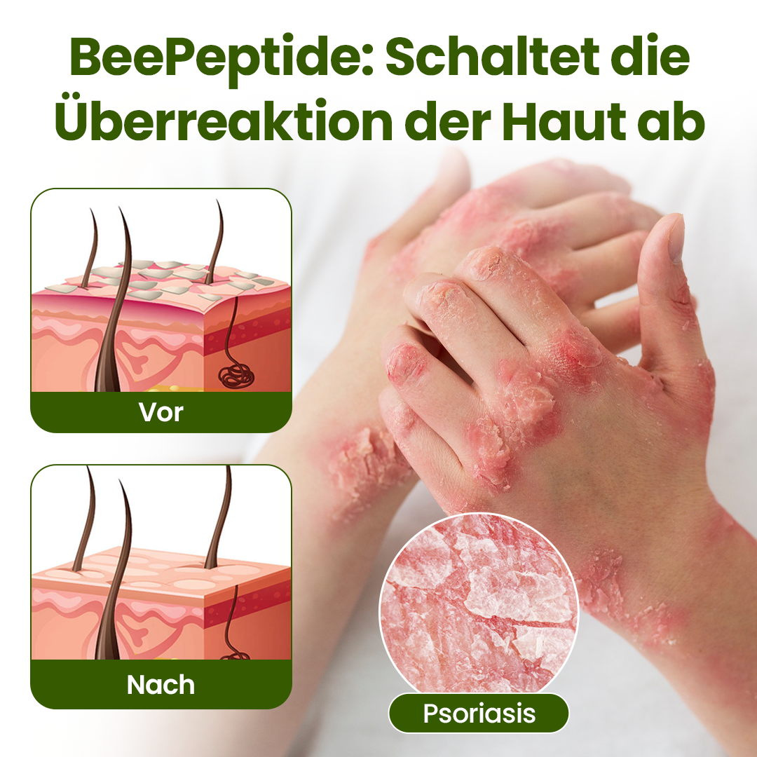 Timilk® BeePeptide RootSoft DualRelief-Creme