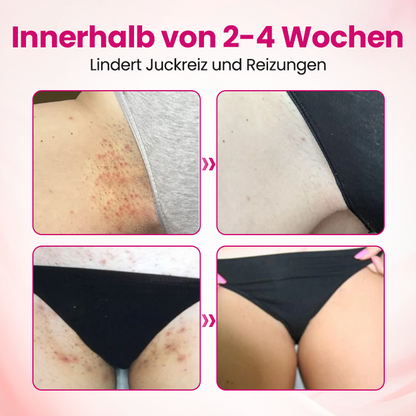 Timilk® IntiDefend Anti-HPV Interferon-Gel🔥