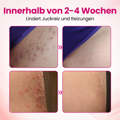 Timilk® IntiDefend Anti-HPV Interferon-Gel🔥