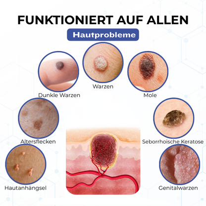Timilk® VanishPro Hautflecken-Entfernungscreme 🇩🇪