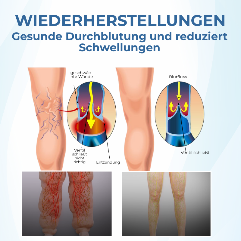Timilk® TheraVein Kräuter-Spray gegen Krampfadern 🔥