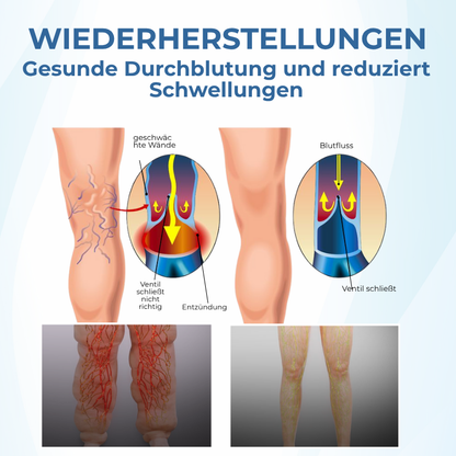 Timilk® TheraVein Kräuter-Spray gegen Krampfadern 🔥