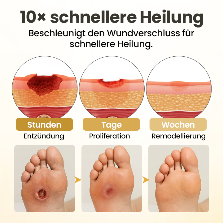 Timilk® GlucaVeil 24H Fuß-Barriere-Spray 🔥