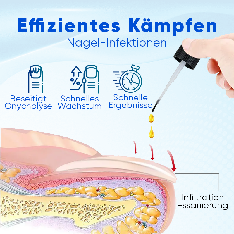 Biancat® OnyxoGuard Nagelwachstums- und Reparaturs Serum