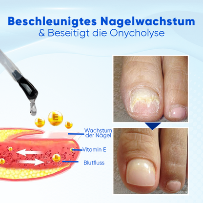 Biancat® OnyxoGuard Nagelwachstums- und Reparaturs Serum