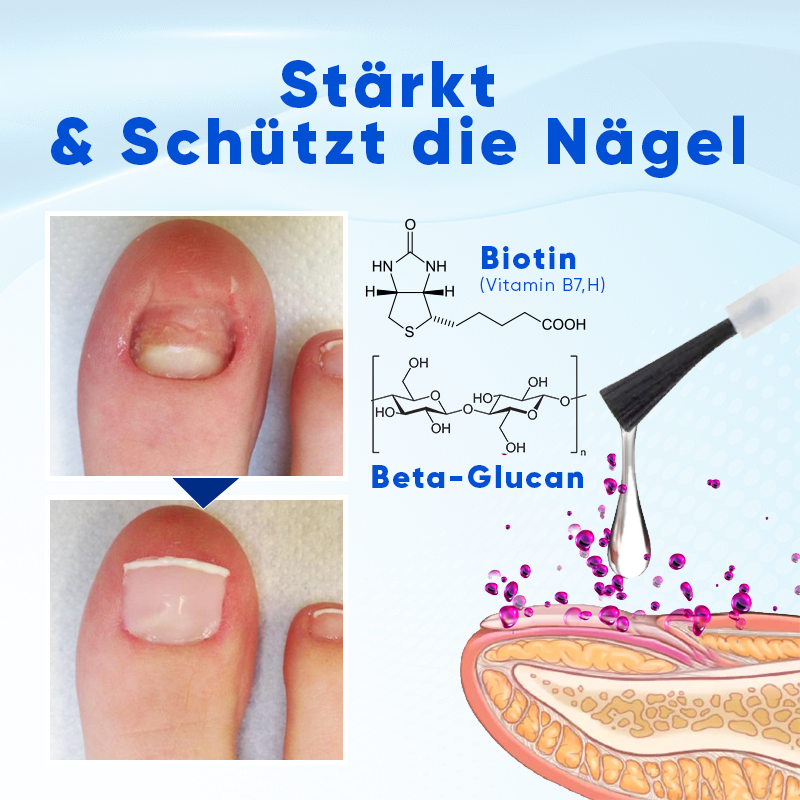 Biancat® OnyxoGuard Nagelwachstums- und Reparaturs Serum